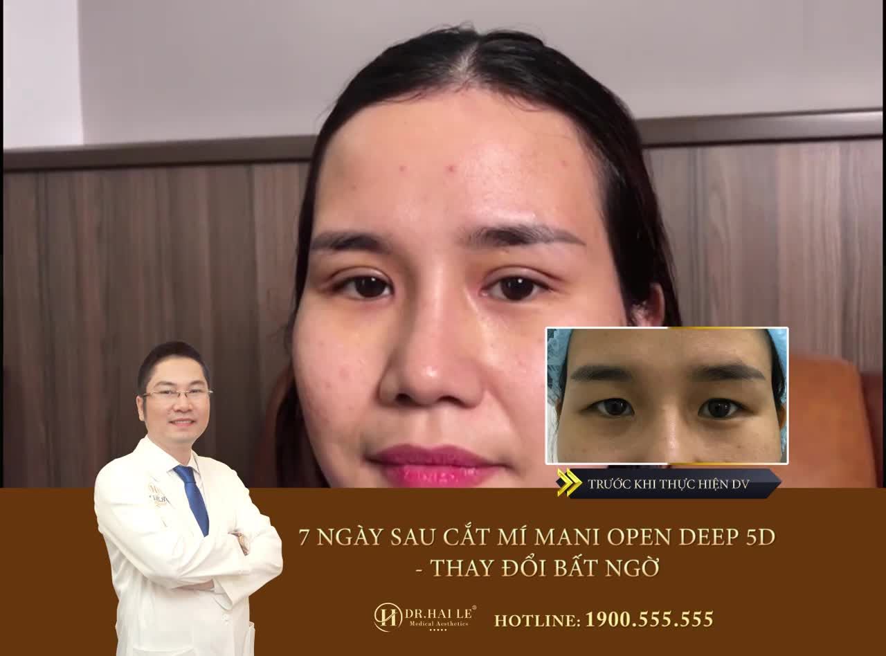 TRI ÂN KHÁCH HÀNG - NGÀY VÀNG GIÁ SỐC CHỚP CƠ HỘI NGAY HÔM NAY‼️