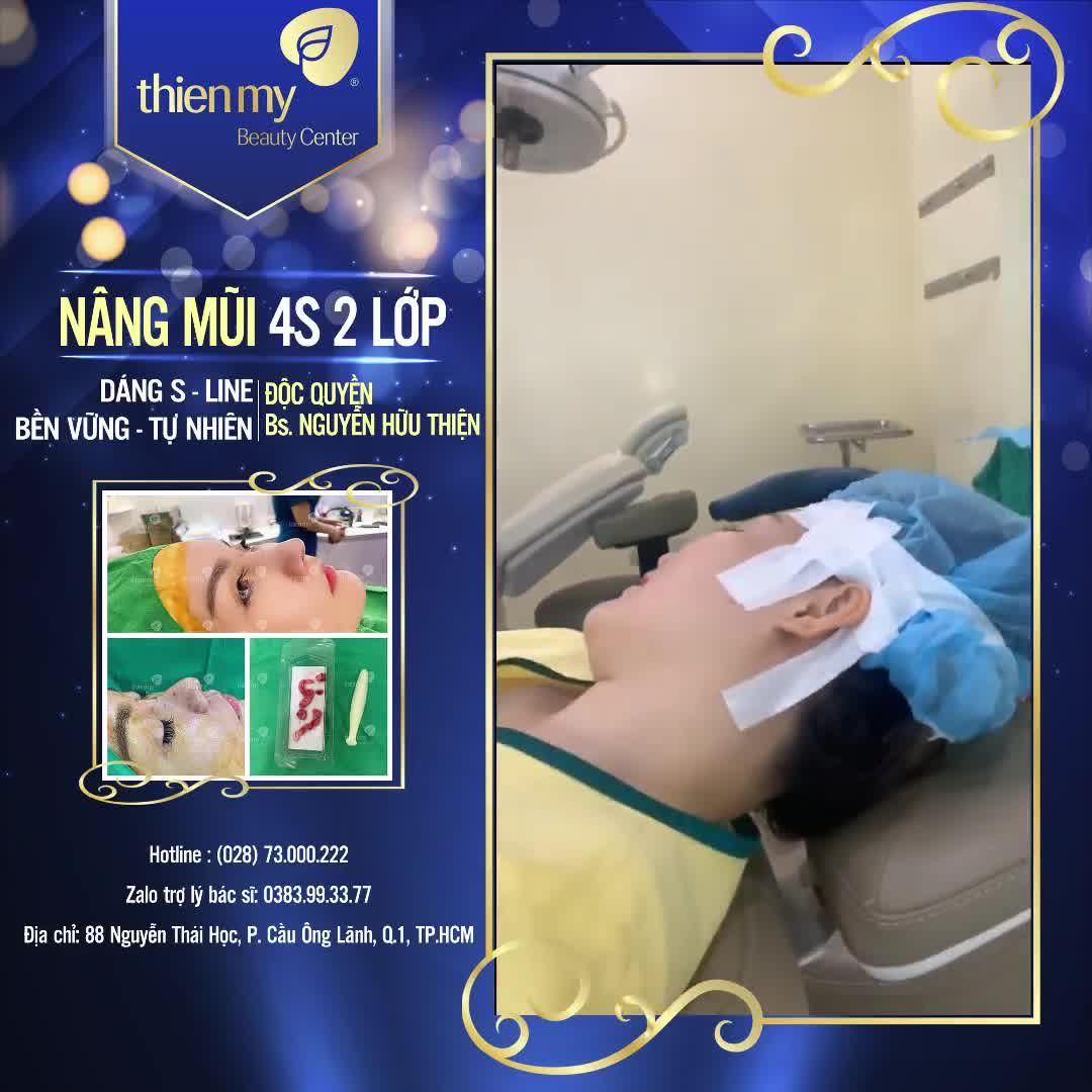 KHÁCH HÀNG GẶP TÌNH TRẠNG TỤT SÓNG DO LÀM MŨI NƠI KHÁC, ĐẦU MŨI VẪN CÒN TO VÀ THÔ, CHÓP MŨI NGẮN.