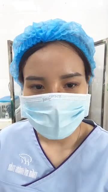 Cải thiện tình trạng gốc mũi thấp tẹt, đầu mũi ngắn hếch cho bạn gái 21 tuổi chỉ trong 30 phút