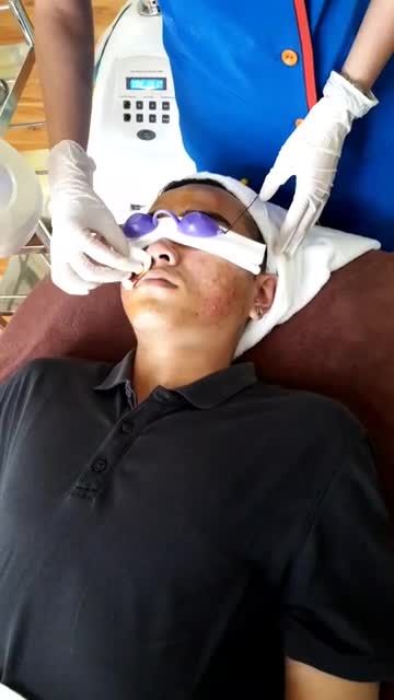 Da "hồi sinh", cải thiện không ngờ sau mỗi buổi trị mụn Nano Skin