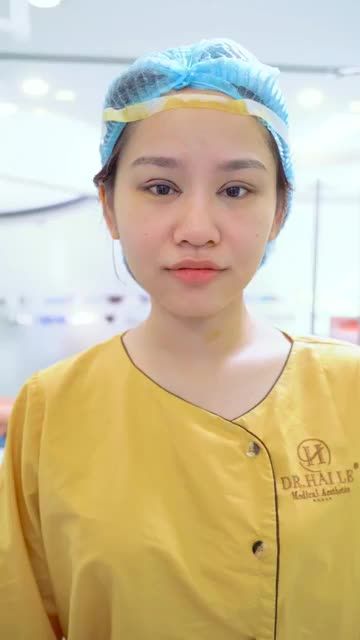 Mở góc mắt trong + Cắt mí Mani Open Deep 5D mang đến cho bạn đôi mắt đẹp sắc nét như thế nào?