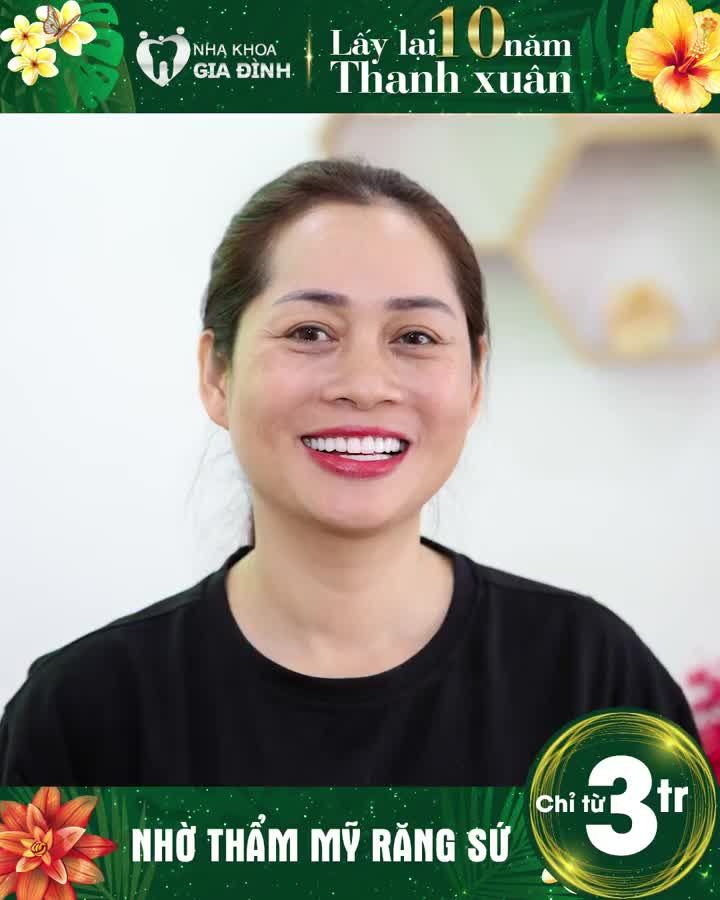 NHỜ THẨM MỸ RĂNG SỨ - LẤY LẠI 10 NĂM THANH XUÂN