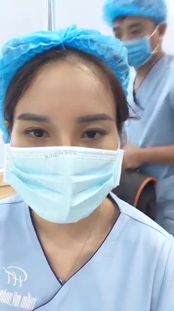 Kết quả một ca mũi sửa đã từng nâng mũi cách đây 6 năm, sau thực hiện nâng mũi cấu trúc Pureform chỉ 30 phút.