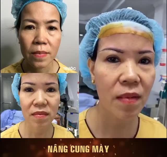 TRẺ RA 10 TUỔI NHỜ THỰC HIỆN 1 DỊCH VỤ BẠN CÓ TIN KHÔNG?