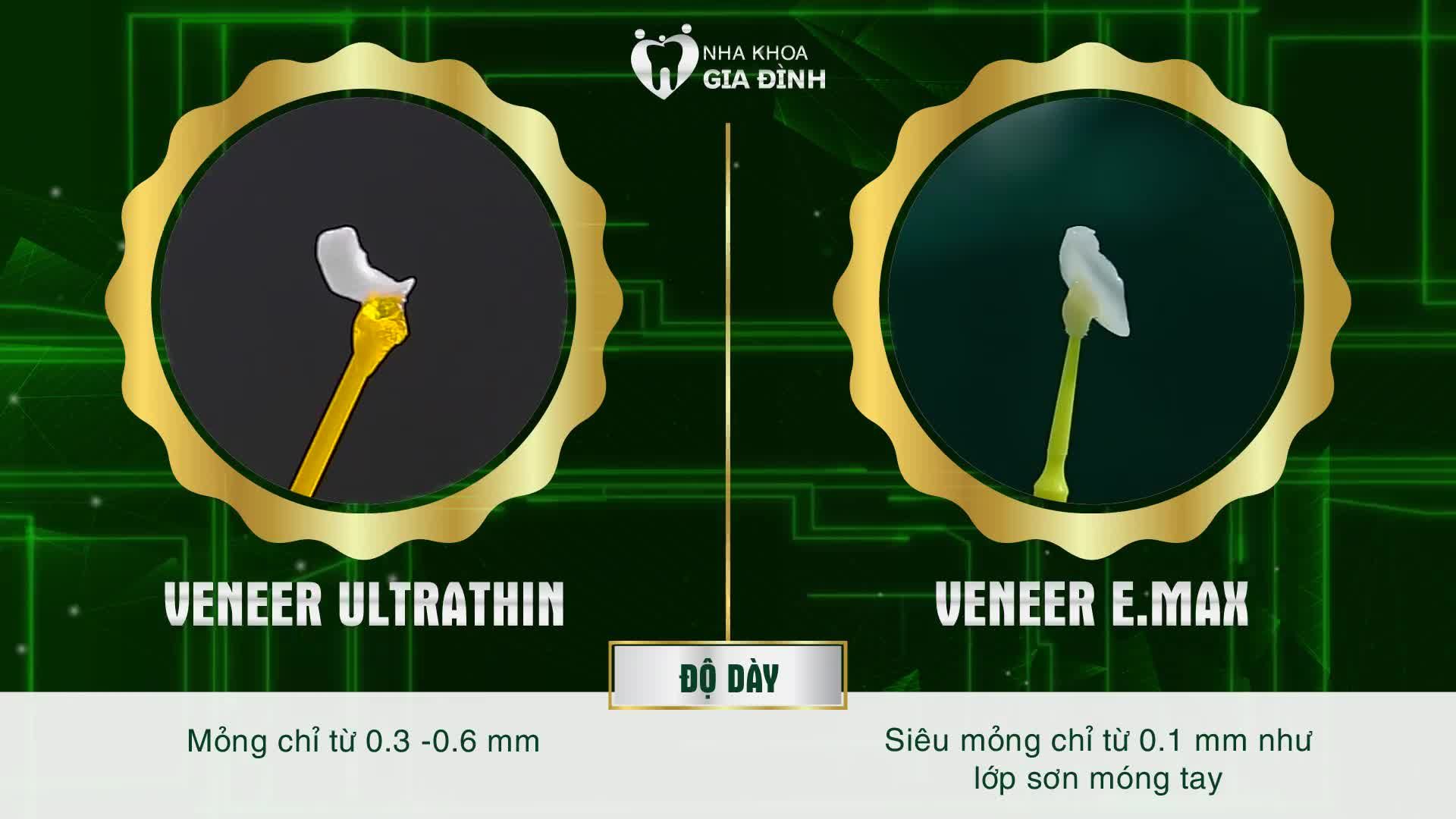 SO SÁNH DÁN SỨ VEEER ULTRATHIN VÀ DÁN SỨ VENEER E.MAX