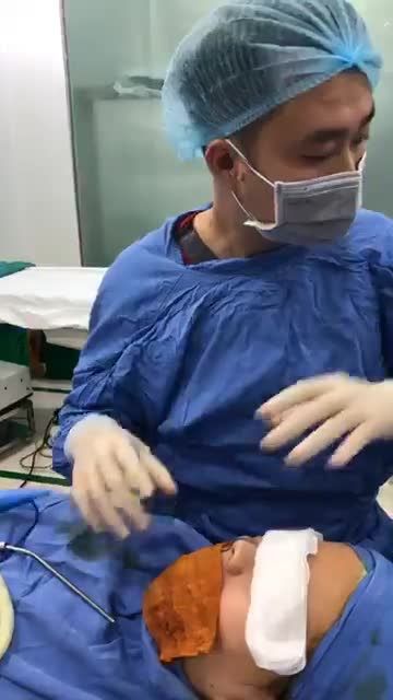 Case nâng mũi cấu trúc 4D cho khách hàng thứ 35