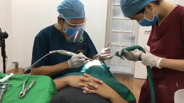 Cấy chân răng nhân tạo răng số 11 cho a Cường tại Nha Khoa Thuỳ Anh.