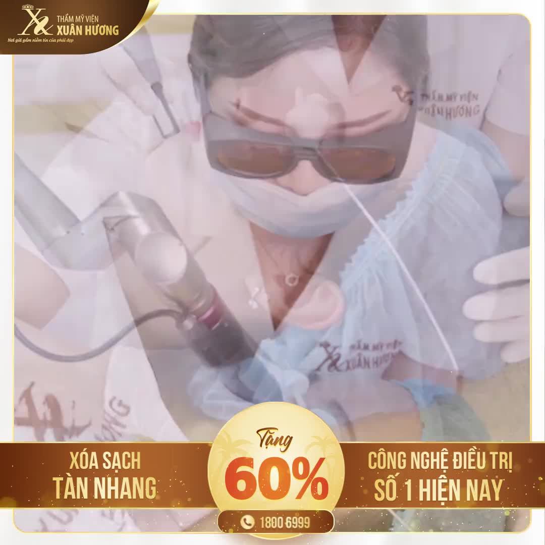GƯƠNG MẶT XINH XẮN NHƯNG DA LẠI KÍN TÀN NHANG