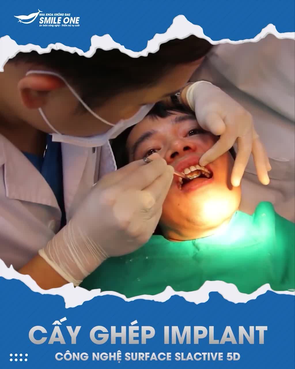 NHẬN NGAY SUẤT CẤY IMPLANT MIỄN PHÍ - DUY NHẤT VÀO NGÀY 22/8