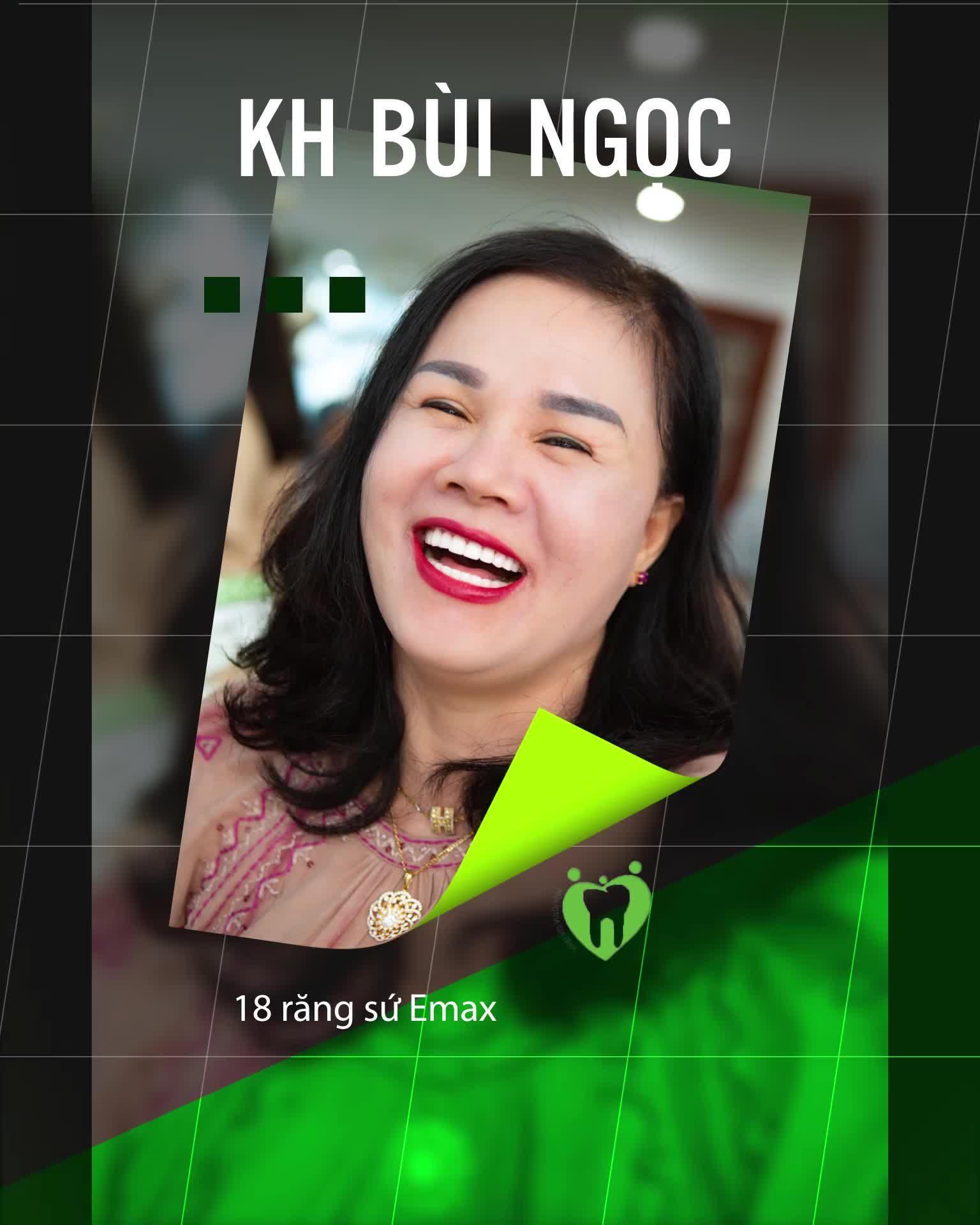CHỚP NGAY CƠ HỘI THAY MỚI NỤ CƯỜI VỚI ƯU ĐÃI CỰC SỐC CHỈ TRONG THÁNG NÀY