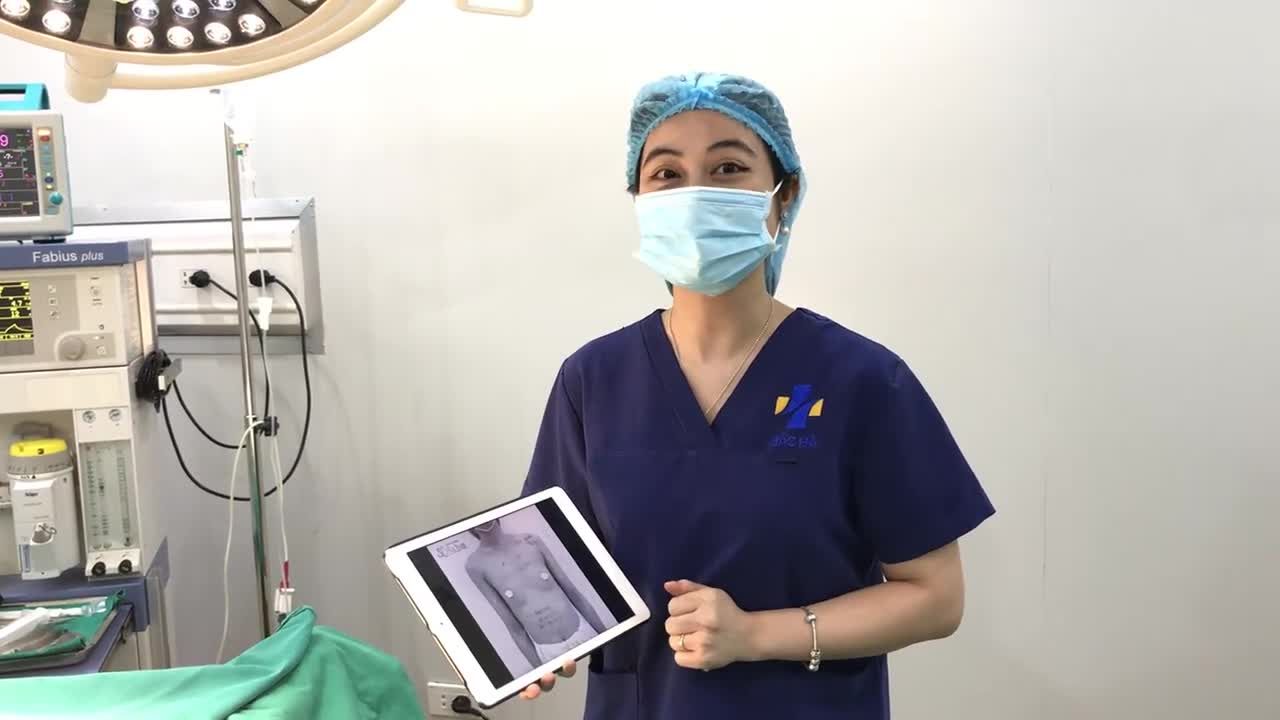 Nâng cấp vòng 1 với dòng túi Mentor sau 60 phút
