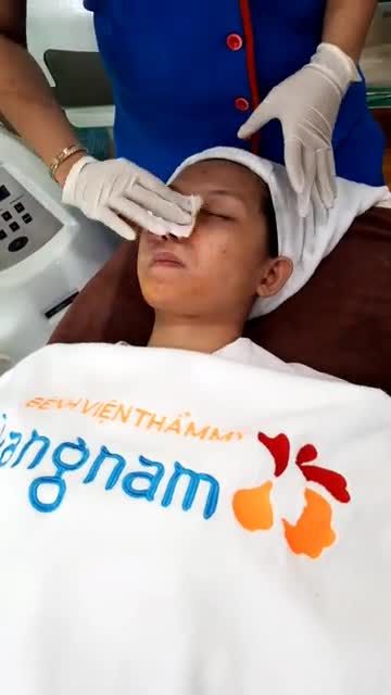 Mụn viêm Mụn bọc Mụn ẩn Điều trị thế nào