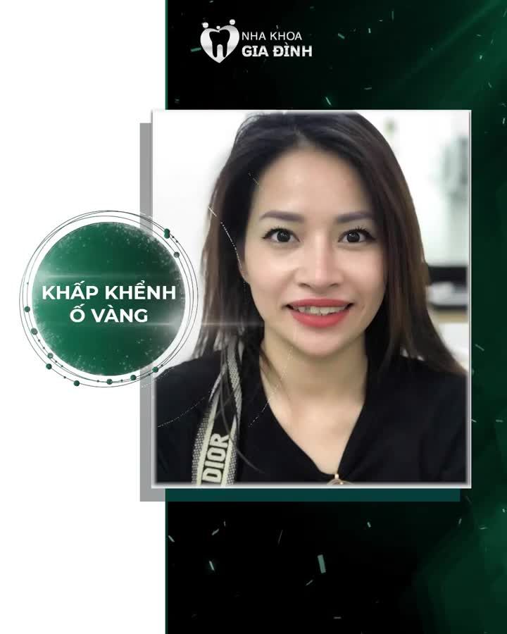 ĐẾN NHA KHOA GIA ĐÌNH LÀ TRẺ RA CHỤC TUỔI THẨM MỸ RĂNG SỨ CHỈ TỪ 2TR/RĂNG