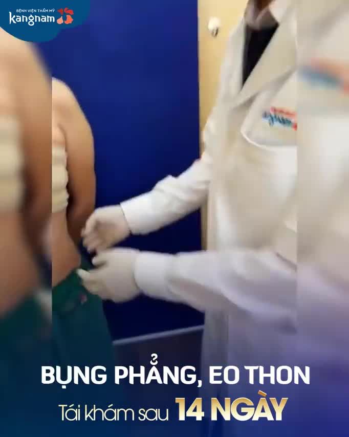 Thoát bụng mỡ, da chùng - Tự tin với vòng 2 siêu phẳng