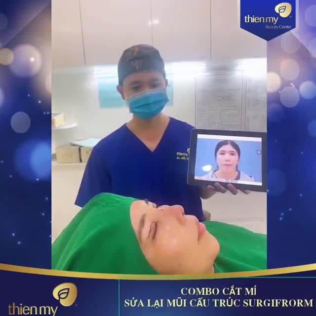 CA MŨI CÓ ĐỘ KHÓ THÁCH THỨC CÁC BÁC SĨ TẠI THIỆN MỸ VỚI CÁC PP CẮT MÍ + SỬA LẠI MŨI TẠI NẠN PP NÂNG MŨI CẤU TRÚC SURGIFORM.