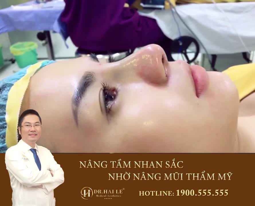 ĐIỀU GÌ KHIẾN BẠN CÒN BĂN KHOĂN KHI NÂNG MŨI THẨM MỸ?