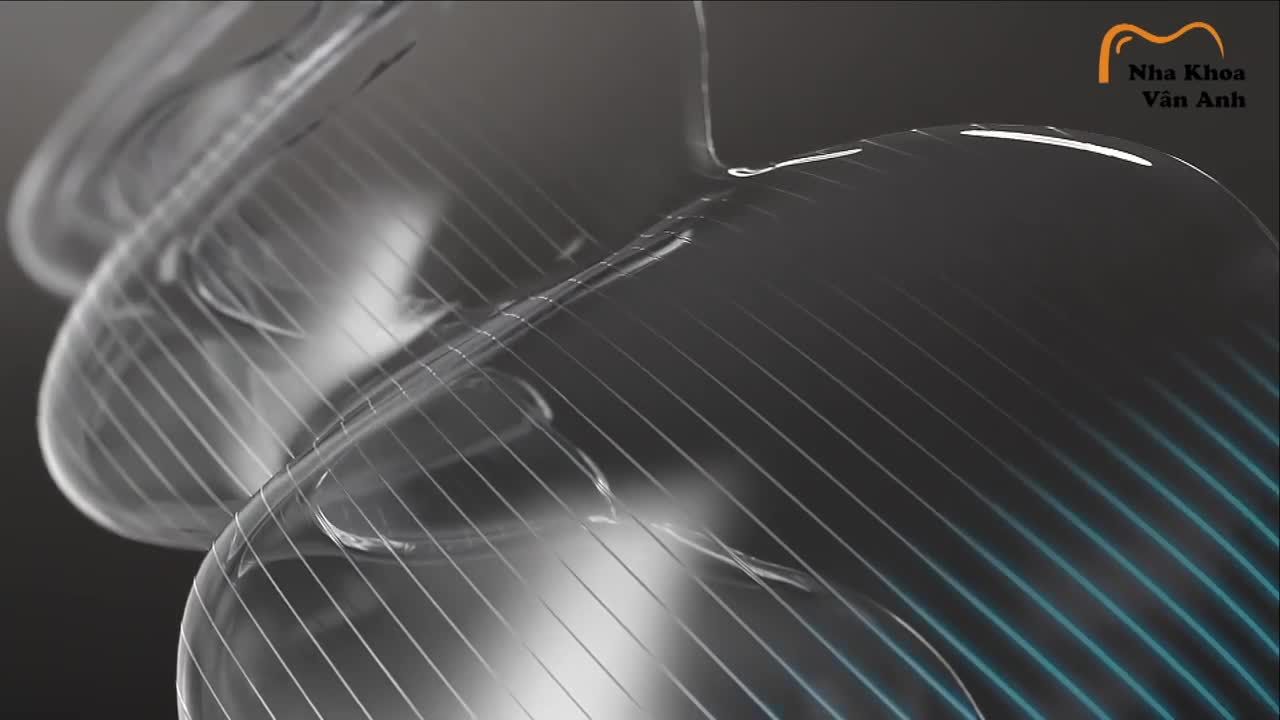 INVISALIGN CÓ THẬT SỰ LÀ  KHAY NIỀNG TRONG SUỐT HIỆU QUẢ SỐ 1 THẾ GIỚI