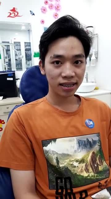 Kiểm tra sau gần 1 năm Chỉnh nha cho khách hàng