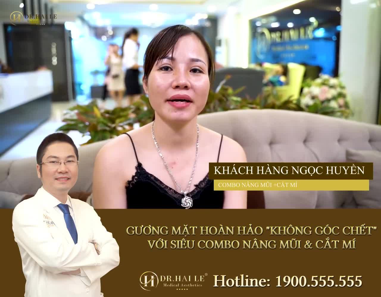 Ngọc Huyền - Combo Nâng Mũi + Cắt mí