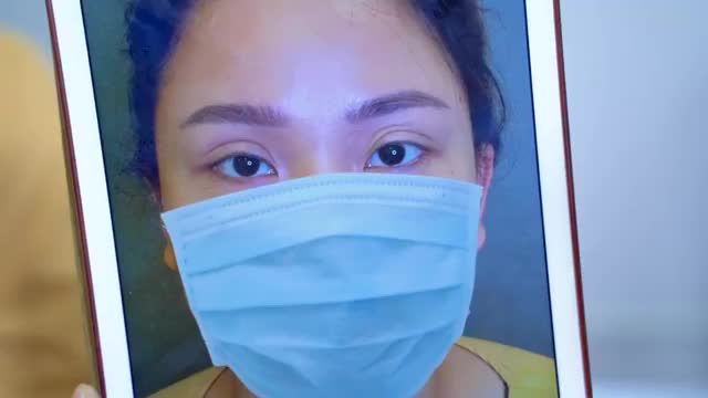 Bạn gái từng cắt mí bị hỏng, dính trần mí mắt tại cơ sở kém uy tín và quyết định tìm tới Dr.Hải Lê để SỬA MÍ DEEP TECH20. Kết quả đẹp hơn cả mong đợi là có thật!