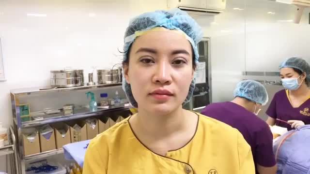 Cận cảnh 1 ca Combo nâng mũi  cắt mí đẹp mê li trong tích tắc. XEM NGAY KẺO LỠ