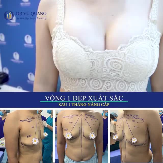 V1 CĂNG TRÒN, TỰ NHIÊN, KHÔNG LÀM TIẾC CẢ THANH XUÂN