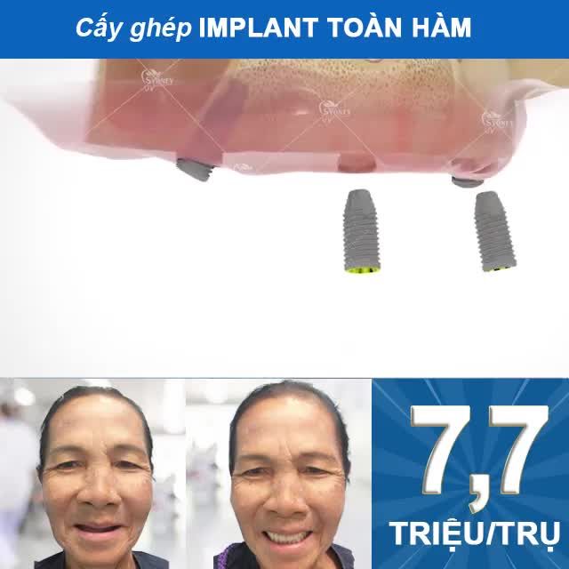AN TOÀN - KHÔNG ĐAU - ĂN NHAI TỰ NHIÊN NHƯ RĂNG THẬT