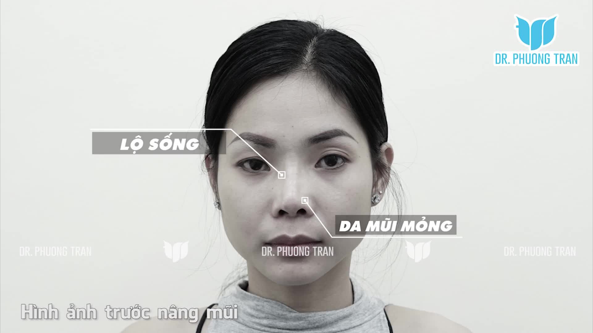 TÔI RẤT THÍCH DÁNG MŨI NÀY