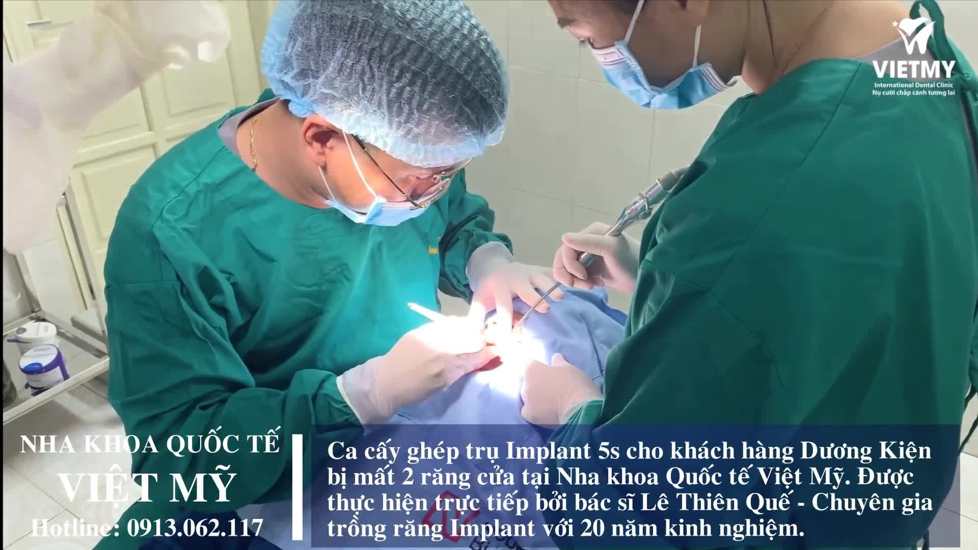 Case  cấy ghép Implant cho khách hàng bị hỏng 2 răng cửa do tai nạn