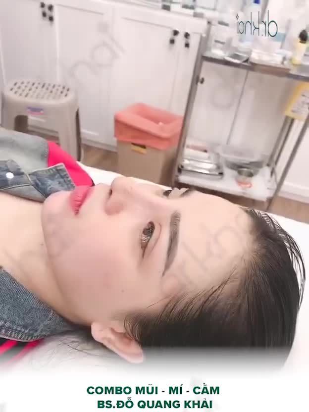 COMBO MŨI MÍ CẰM CHO DIỆN MẠO HOÀN HẢO!