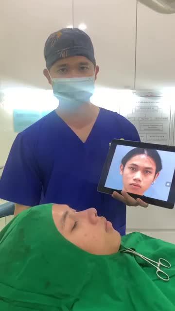KHÁCH HÀNG NAM TRỞ NÊN NAM TÍNH - MẠNH MẼ HƠN SAU KHI THAY ĐỔI DÁNG MŨI CẤU TRÚC S - LINE TẠI TMV THIỆN MỸ
