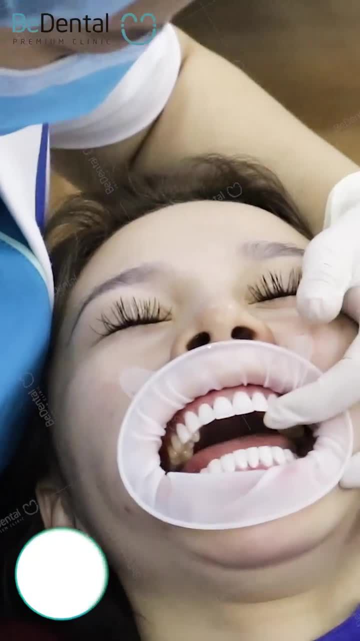 LÀM RĂNG SỨ TẠI BE - VỪA ĐẸP LẠI AN TOÀN