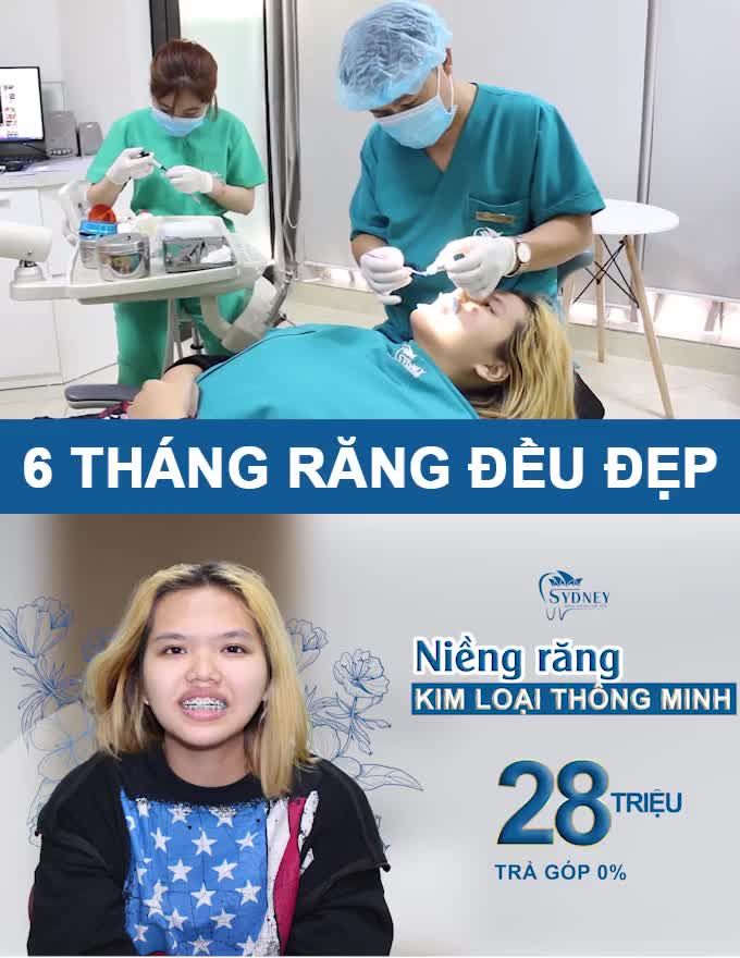 MẮC CÀI KIM LOẠI THÔNG MINH CÓ XỨNG ĐÁNG VỚI GIÁ TIỀN