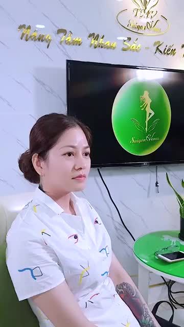 MỘT CASE TÁI KHÁM DỊCH VỤ NÂNG MŨI SỤN SƯỜN GẦN 3 THÁNG THỰC HIỆN