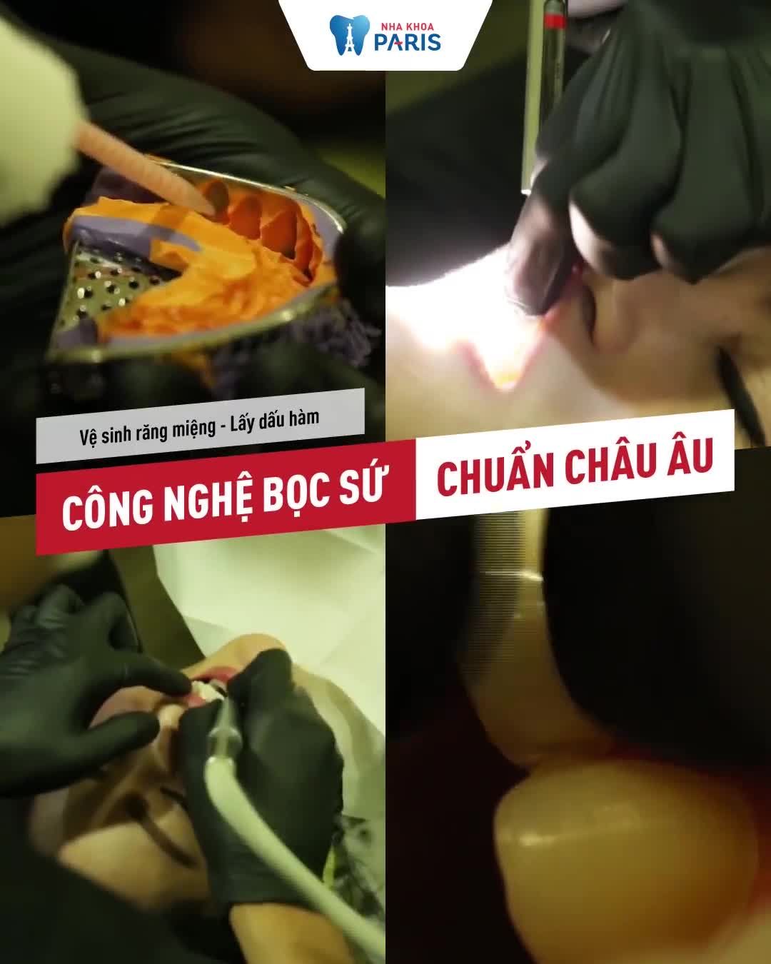 RĂNG SỨ TRẮNG THÔI CHƯA ĐỦ