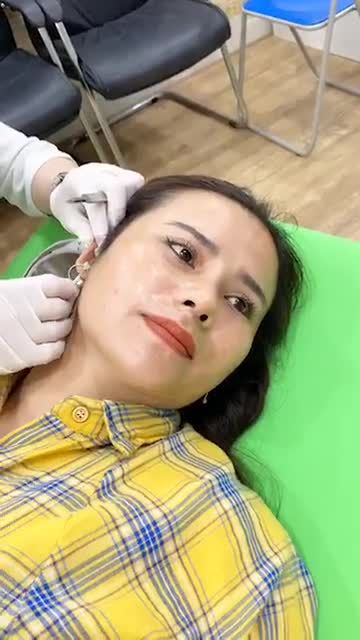 Sau 12 ngày quay lại cắt chỉ tại mhbeauty