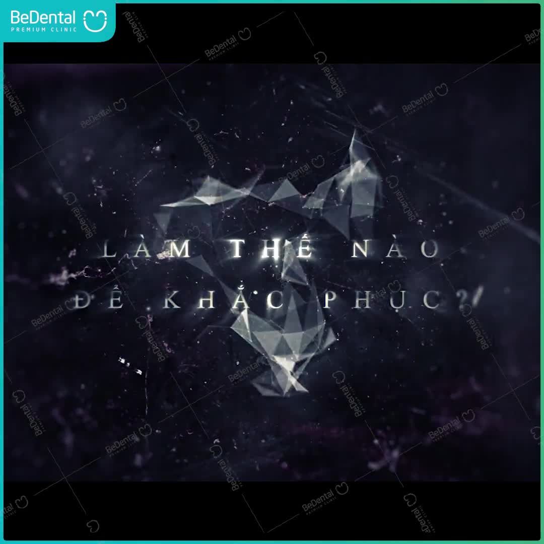 Thẩm mỹ răng sứ khắc phục răng yếu, gãy hỏng, mất răng...Phục hình lại chức năng ăn nhai và bảo vệ sức khỏe răng miệng