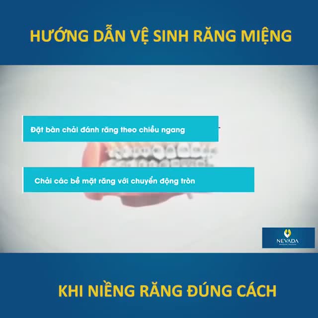 VỆ SINH RĂNG MIỆNG ĐÚNG CÁCH SAU NIỀNG RĂNG - BẠN ĐÃ BIẾT CHƯA