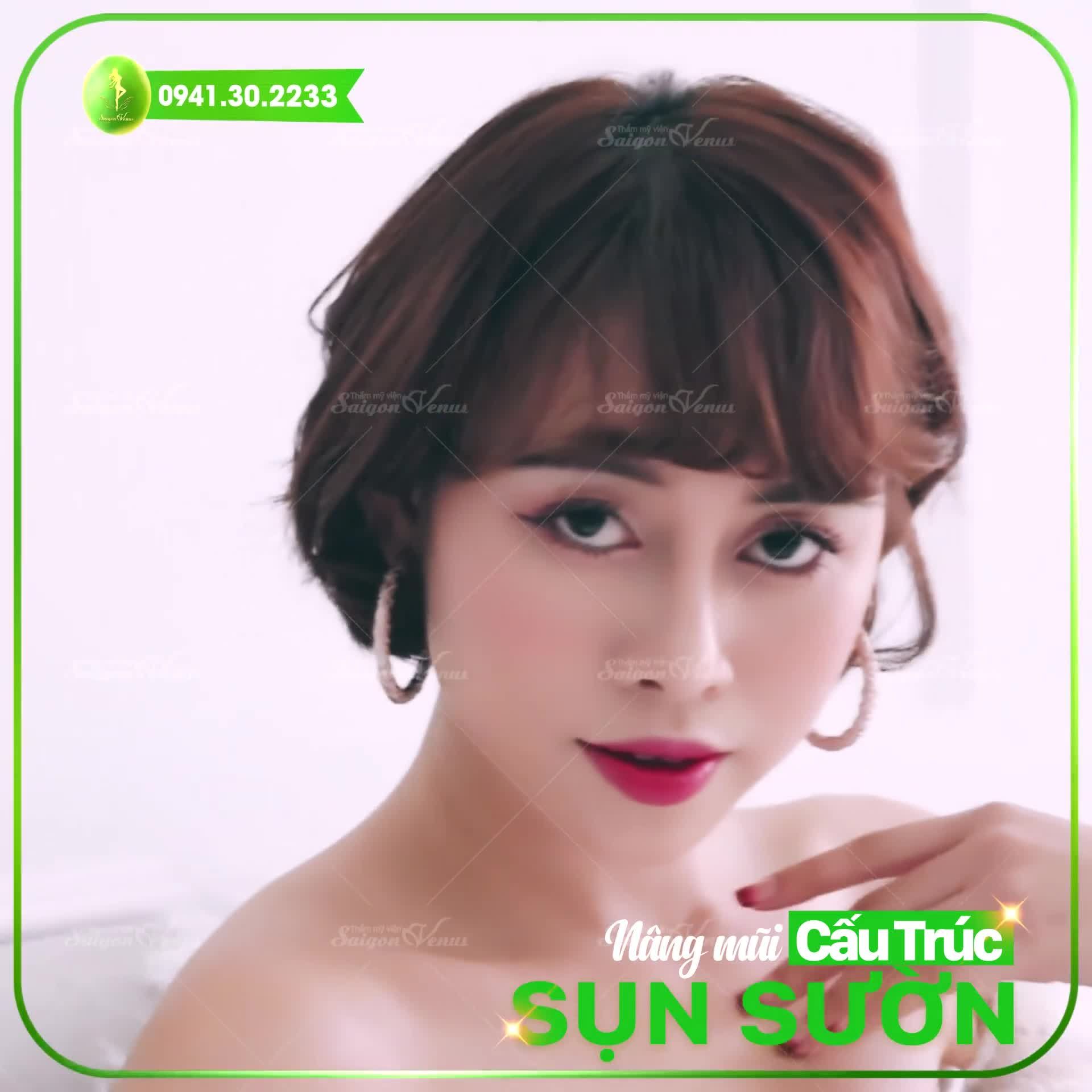 DIỄN VIÊN PHƯƠNG THOA "LỘT XÁC" SAU TÁI PHẪU THUẬT NÂNG MŨI