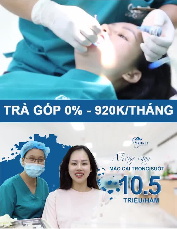 Lợi ích khi niềng răng sớm