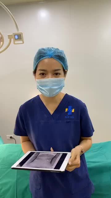 XOÁ BỎ “MÀN HÌNH PHẲNG” VỚI NANOCHIP EG TRỌN GÓI CHỈ 57tr900