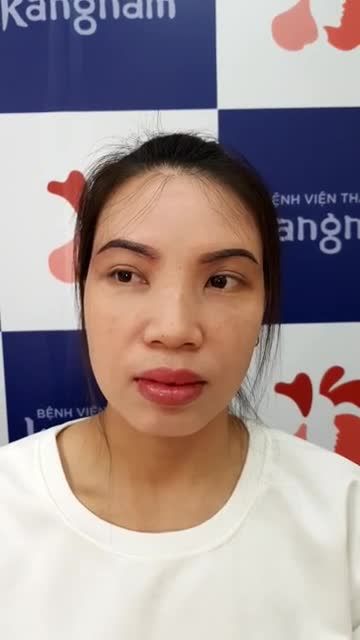 Khách hàng thực hiện dịch vụ NÂNG CUNG MÀY cắt chỉ sau 7 ngày. Bấm xem ngay