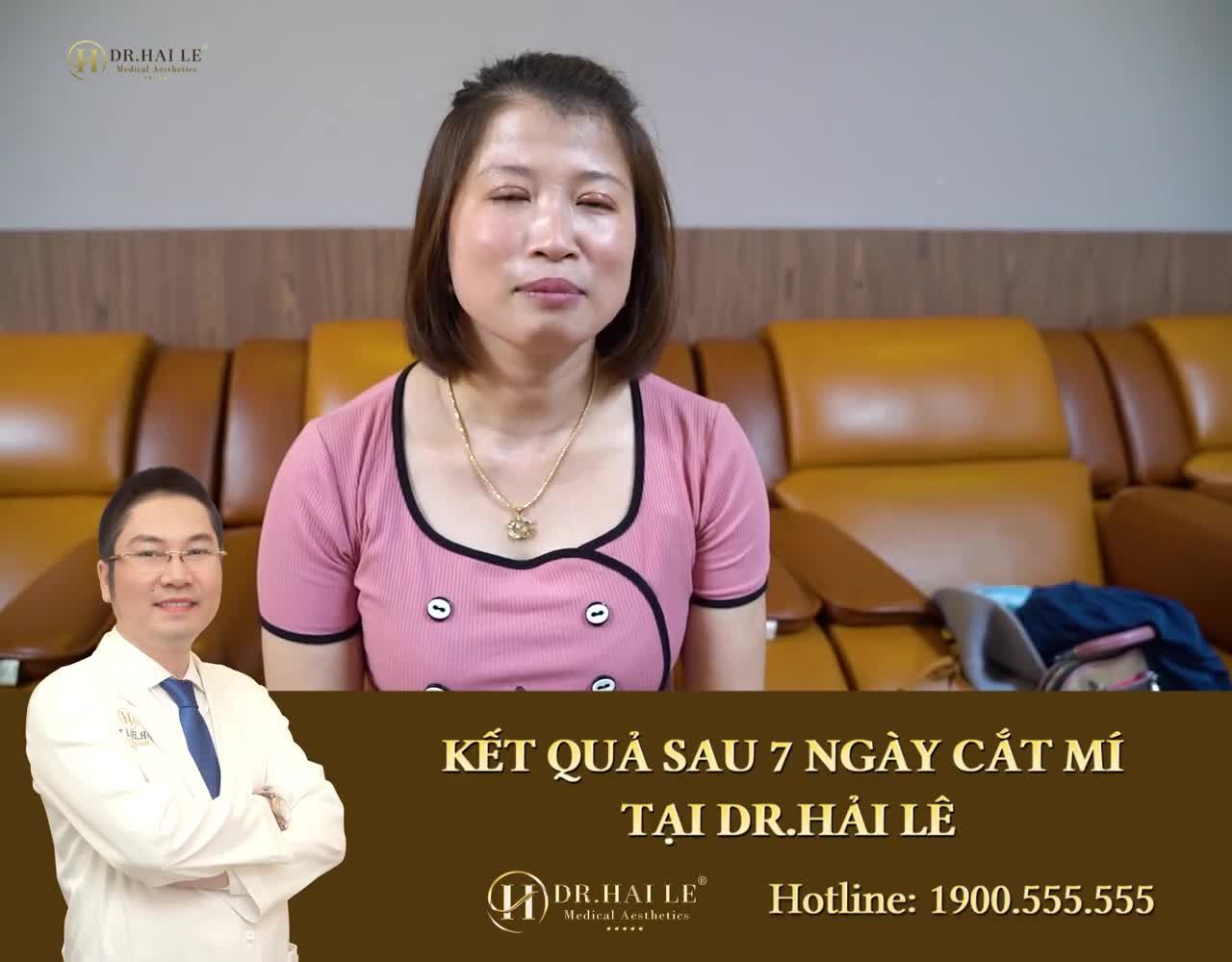 TỦI THÂN VÌ MỌI NGƯỜI XUNG QUANH ĐỀU CÓ MÍ ĐẸP, RIÊNG MÌNH THÌ KHÔNG.!
