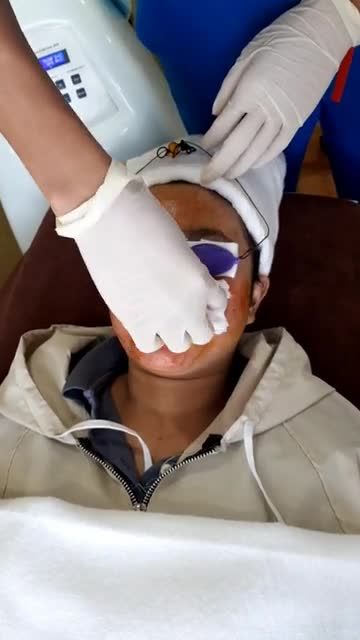 Sau 5 BUỔI  Diệt gọn MỤN ẨN, MỤN BỌC