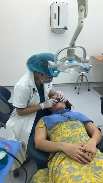 Case mài răng sứ cho KH đến từ Hà Tĩnh