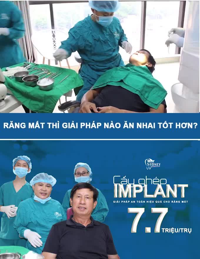 Cấy ghép implant là phương pháp hoàn hảo để thay thể răng đã mất