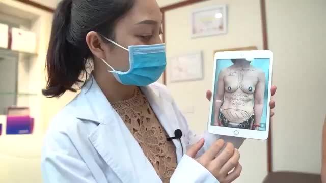 “CHỊ CẢM THẤY VÔ CÙNG HẠNH PHÚC VÀ TỰ TIN “ -KH chia sẻ sau khi thực hiện combo Nâng Cấp V1 + Cấy Mỡ Mặt Bio Nano