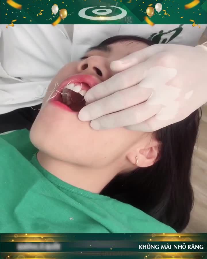 ĐỪNG BỎ QUA CƠ HỘI VÀNG CẢI THIỆN HÀM RĂNG KHIẾM KHUYẾT