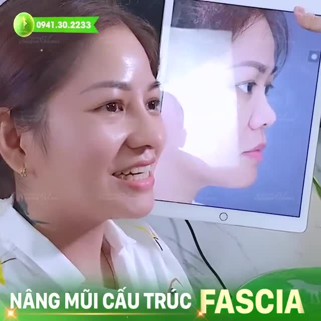 NỤ CƯỜI HÀI LÒNG CỦA CHỊ KHÁNH SAU HƠN 1 THÁNG NÂNG MŨI TẠI TMV VENUS