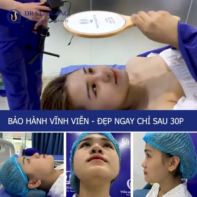 XINH LUNG LINH” luôn mấy chị , mũi mới sau 10 ngày tuổi thôi ạ